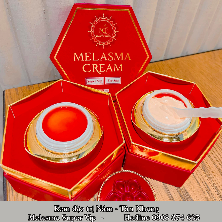 Kem Nám Melasma Cream Super Vip - Đặc trị nám, tàn nhang, đồi mồi sau 1 liệu trình